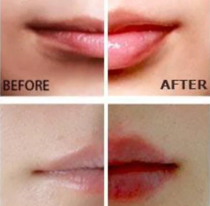 Miracle Lip Plumper My Store